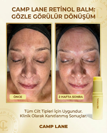 Retinol Cream Stick – Kırışıklık Karşıtı & Onarıcı (Göz ve Hassas Bölgeler)